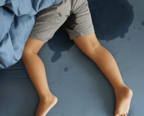 Child wetting bed, lying on blue sheets.